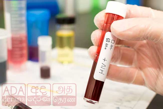 எச்.ஐ.வி அபாயத்தைத் தடுக்க ஒரு புதிய சிகிச்சை முறை