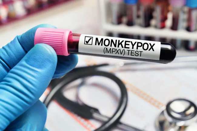 இலங்கையை வந்தடைந்த இருவருக்கு monkeypox