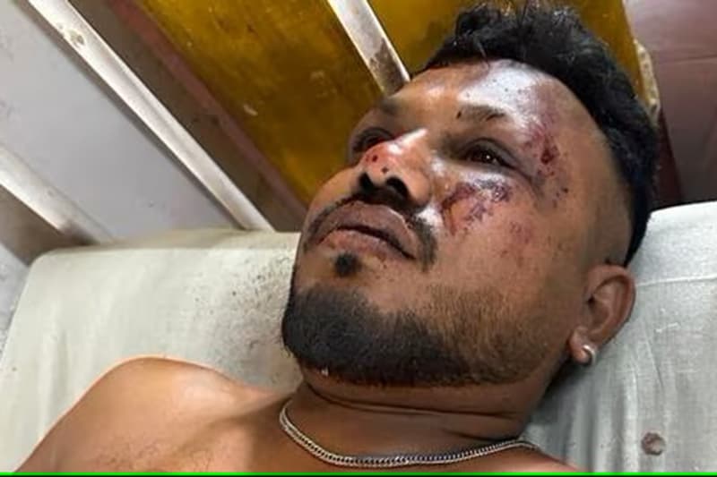 அஹமதாபாத் விமான விபத்து: உயிர் பிழைத்த பயணி!